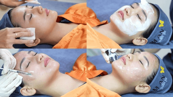 Quy Trình Thực Hiện Tiêm Meso Căng Bóng Da